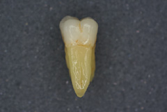 大臼歯02